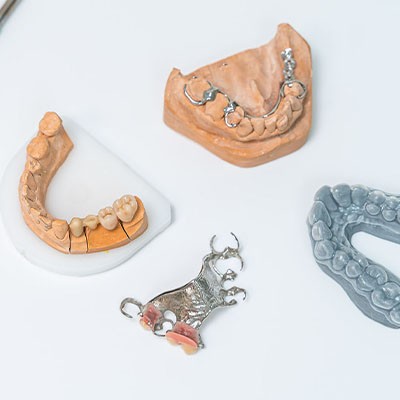 Prothèse dentaire pour remplacer des dents manquantes à Namur